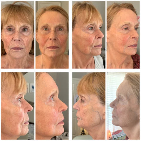 Time Master Pro® with HOP+ Volumizing Gel