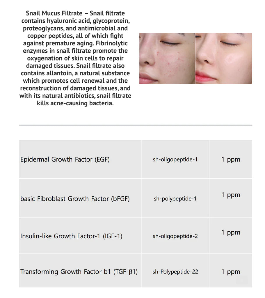 Before-and-after photos showing improved skin clarity from Snail Mucus Filtrate, alongside a table listing growth factor ingredients EGF, bFGF, IGF-1, and TGF-β1 at 1ppm each.
